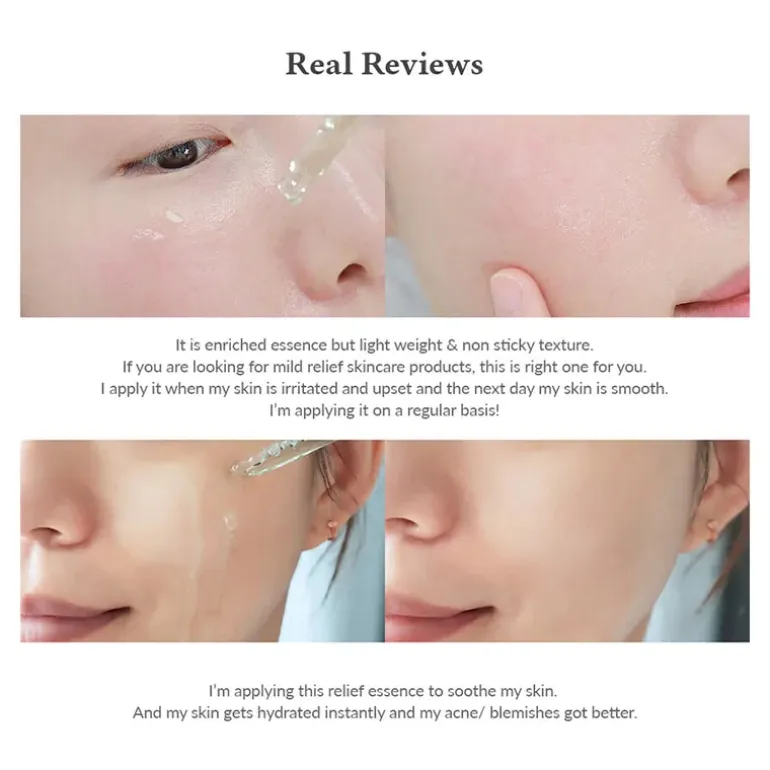 Skin Relief Essence